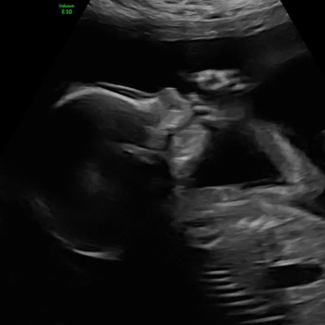 Photo shared by Amanda for their Babylist baby registry.