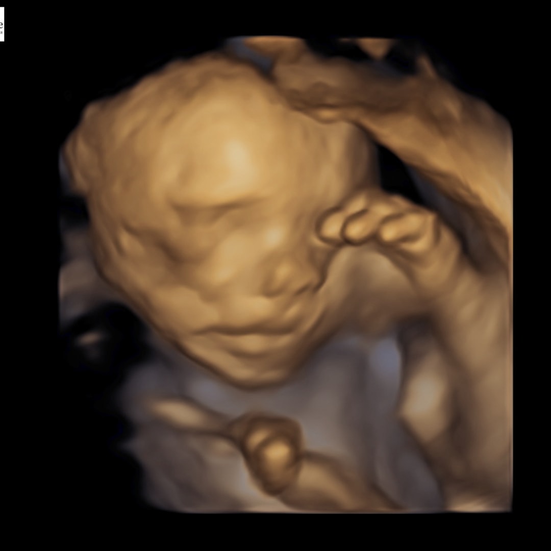 Photo shared by Jennifer for their Babylist baby registry.