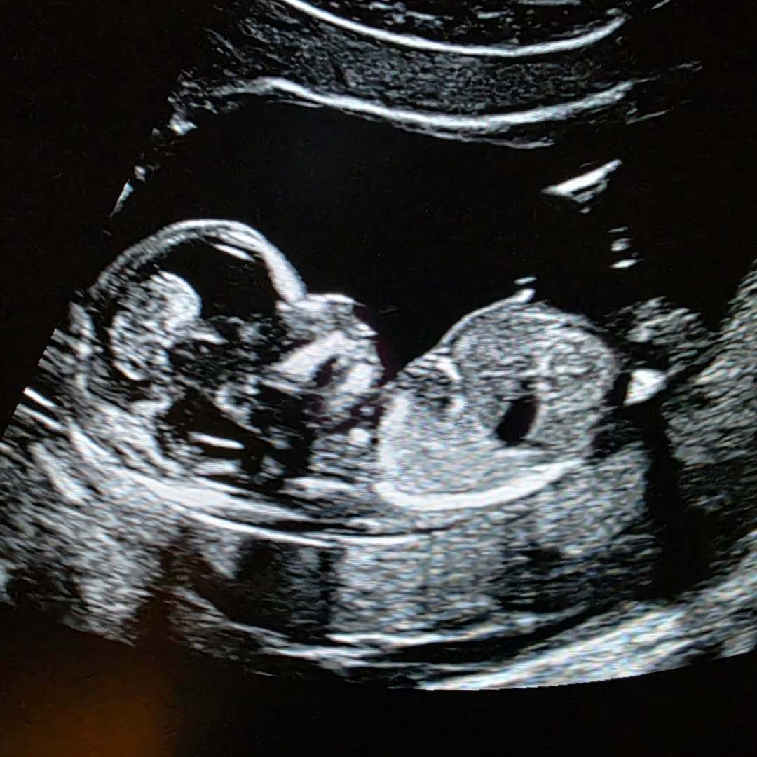 Photo shared by Ash for their Babylist baby registry.