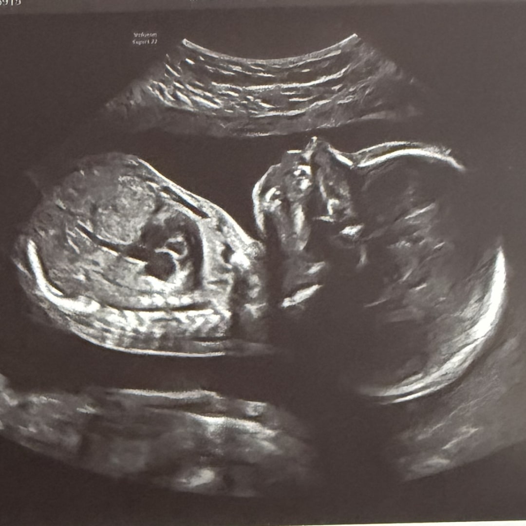 Photo shared by Jenna for their Babylist baby registry.