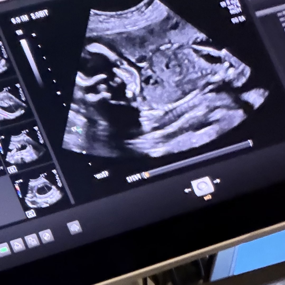 Photo shared by Journey for their Babylist baby registry.