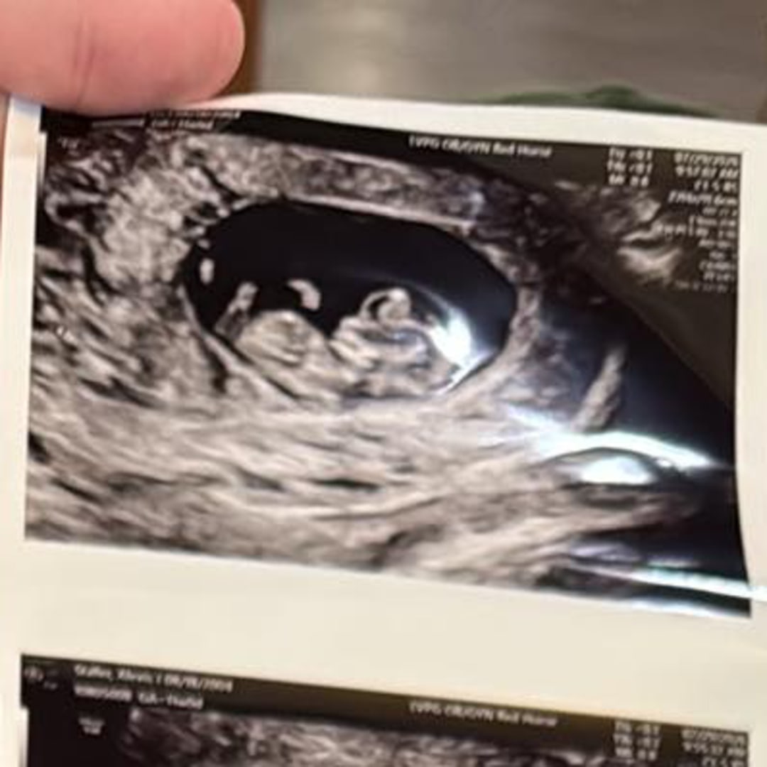Photo shared by Alexis for their Babylist baby registry.