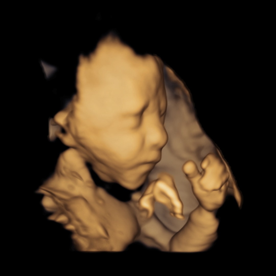 Photo shared by Jennifer for their Babylist baby registry.