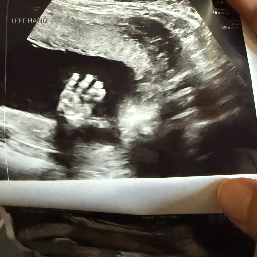 Photo shared by Elissa for their Babylist baby registry.