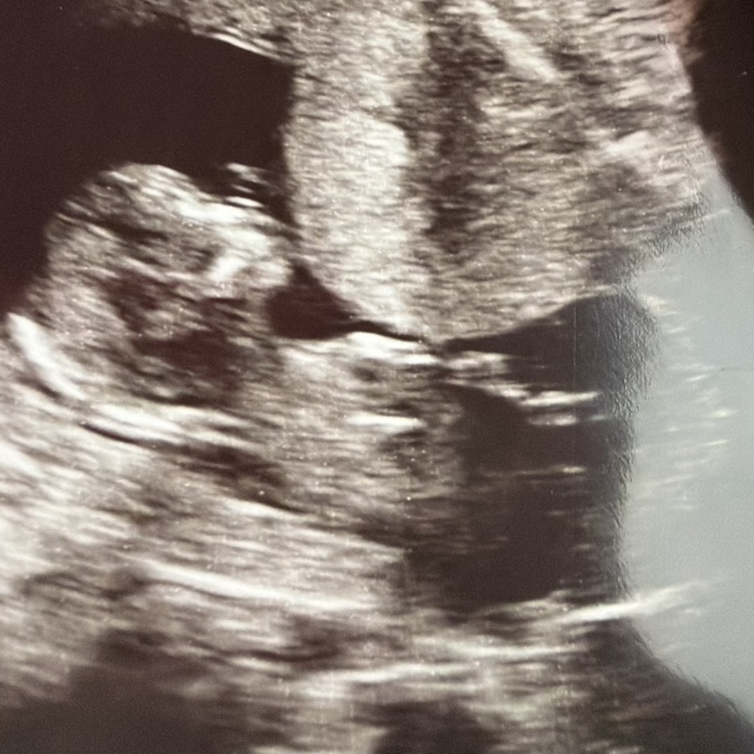 Photo shared by Ashlei for their Babylist baby registry.