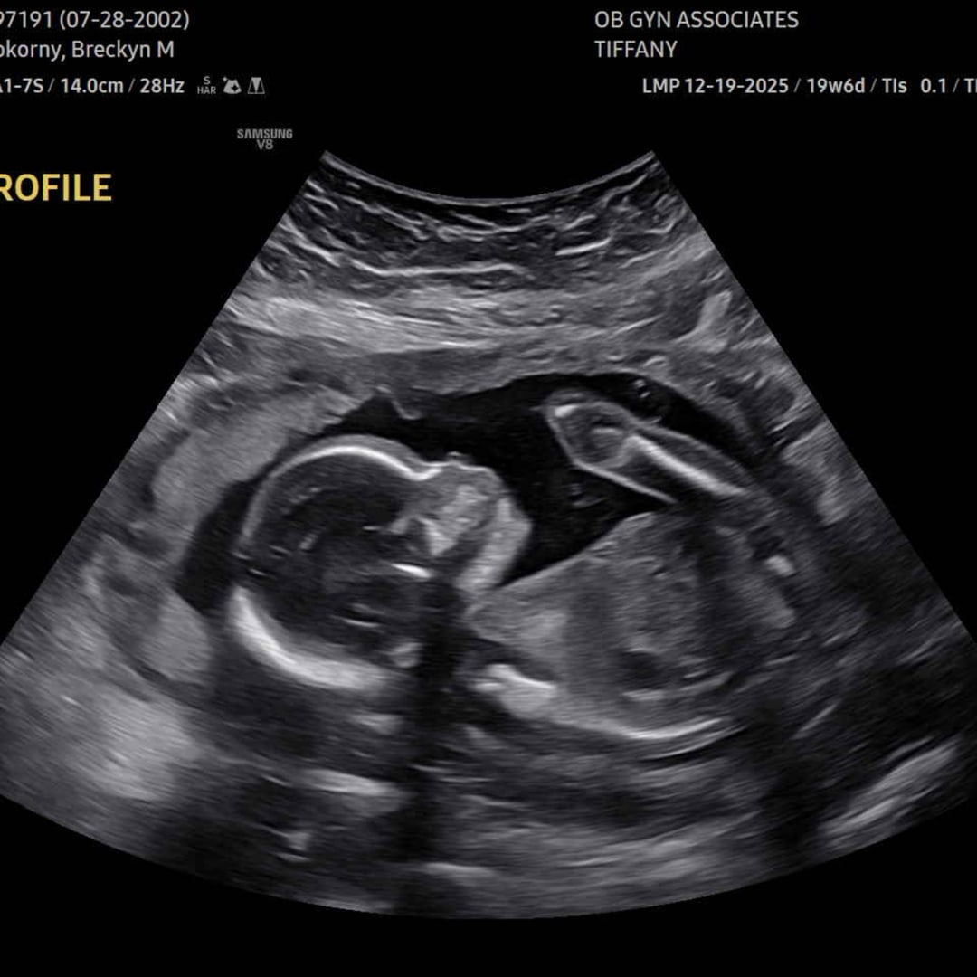 Photo shared by Breckyn for their Babylist baby registry.