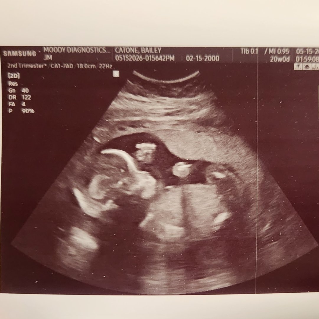 Photo shared by Bailey for their Babylist baby registry.
