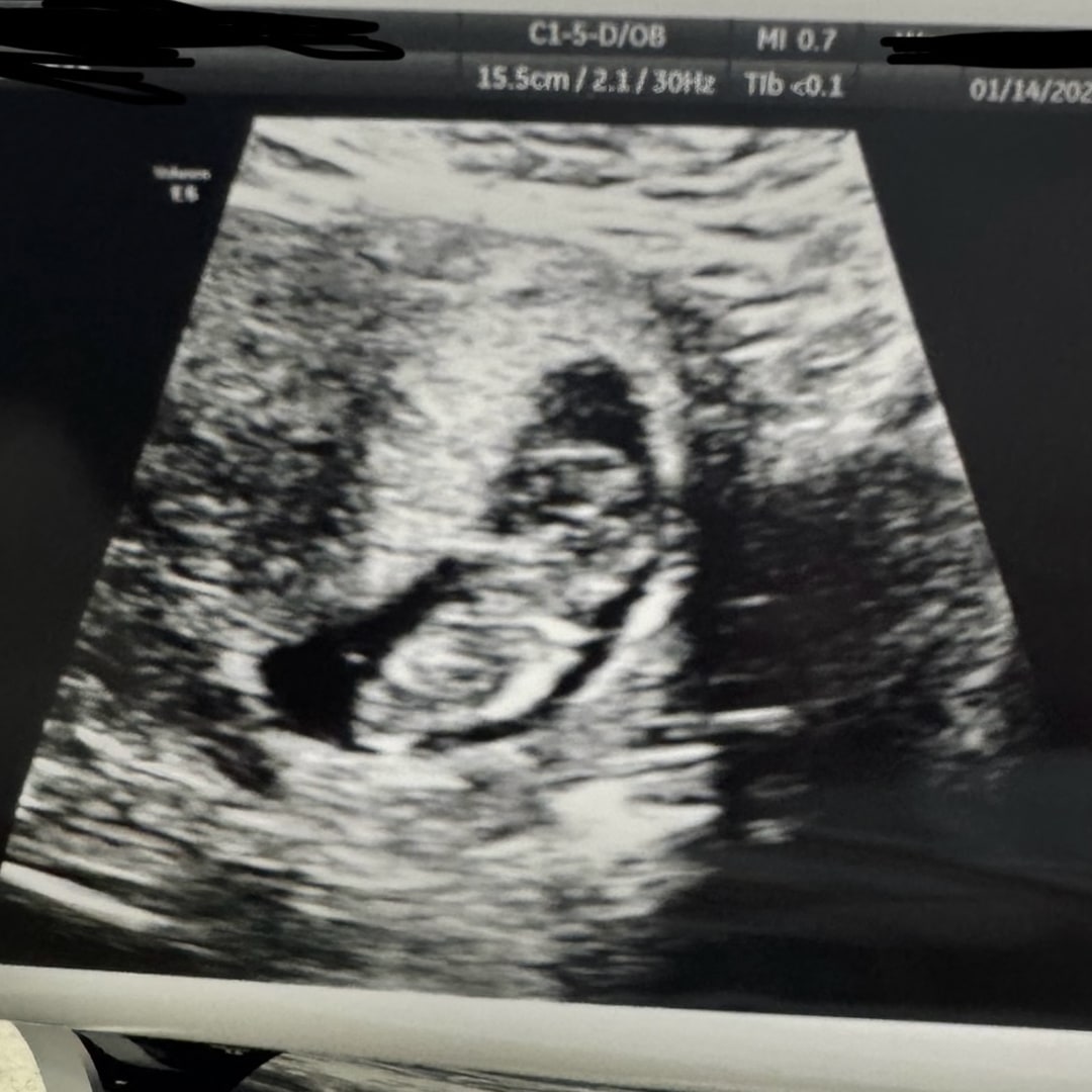 Photo shared by Alexis for their Babylist baby registry.