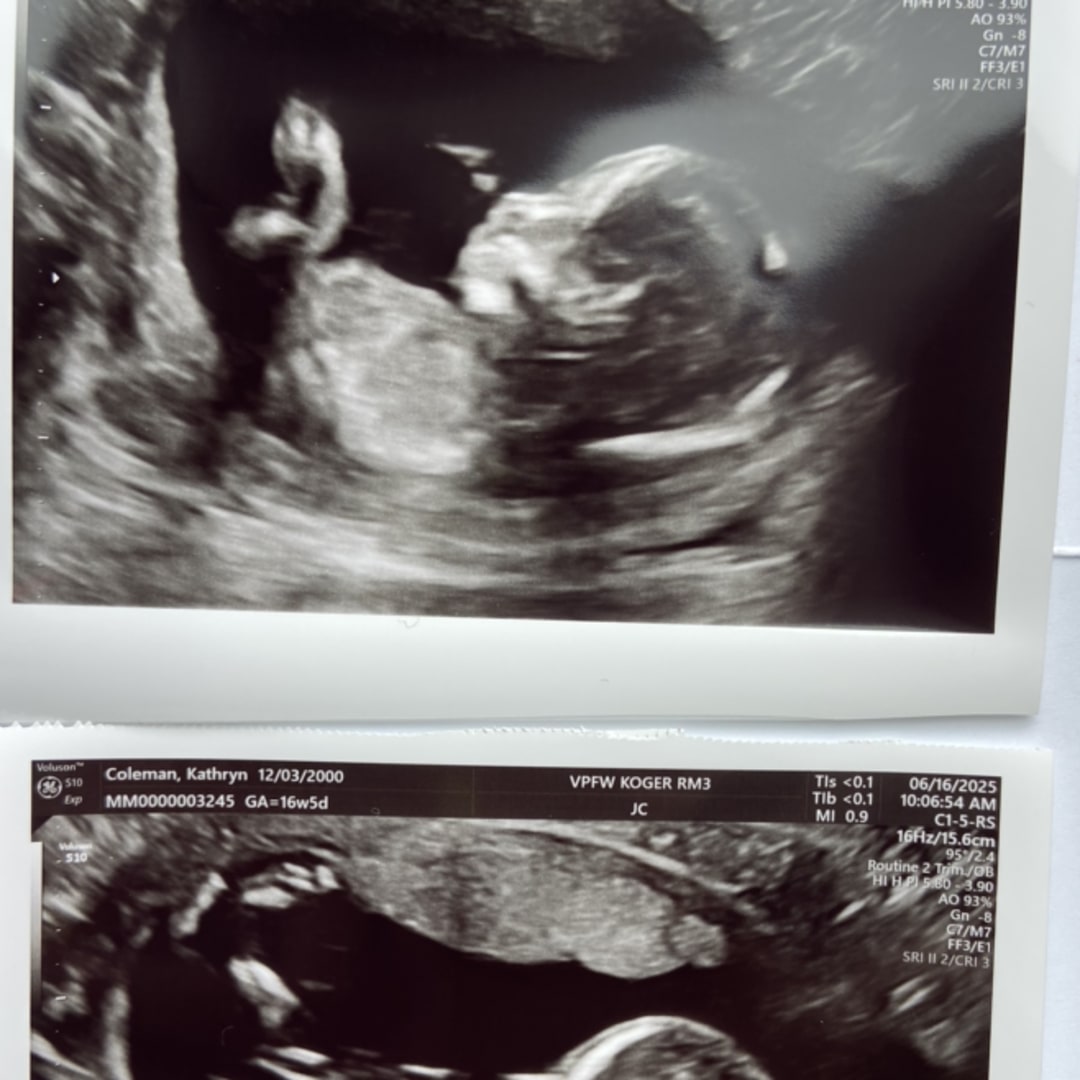 Photo shared by Katy for their Babylist baby registry.