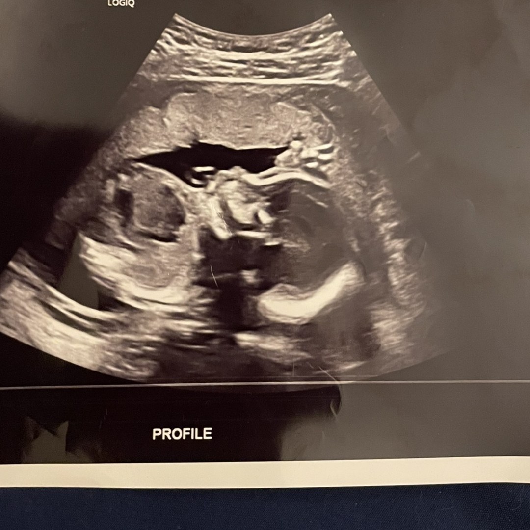 Photo shared by Alianah for their Babylist baby registry.