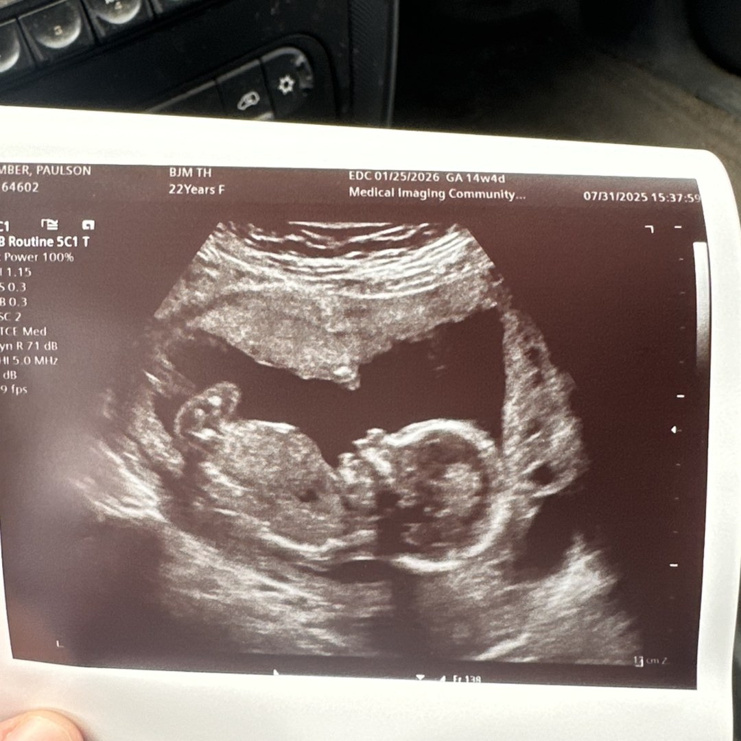 Photo shared by Amber for their Babylist baby registry.