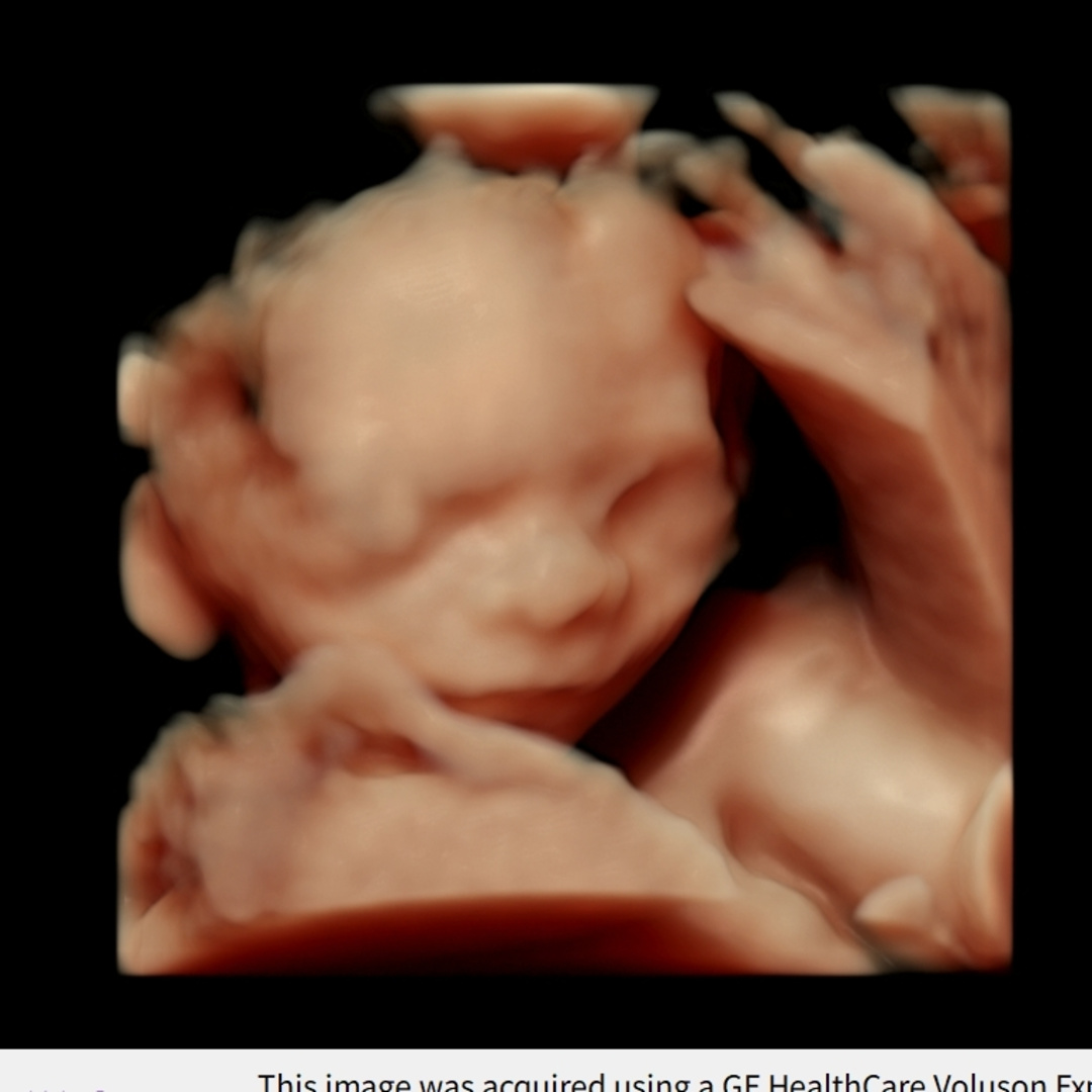 Photo shared by Danielle for their Babylist baby registry.