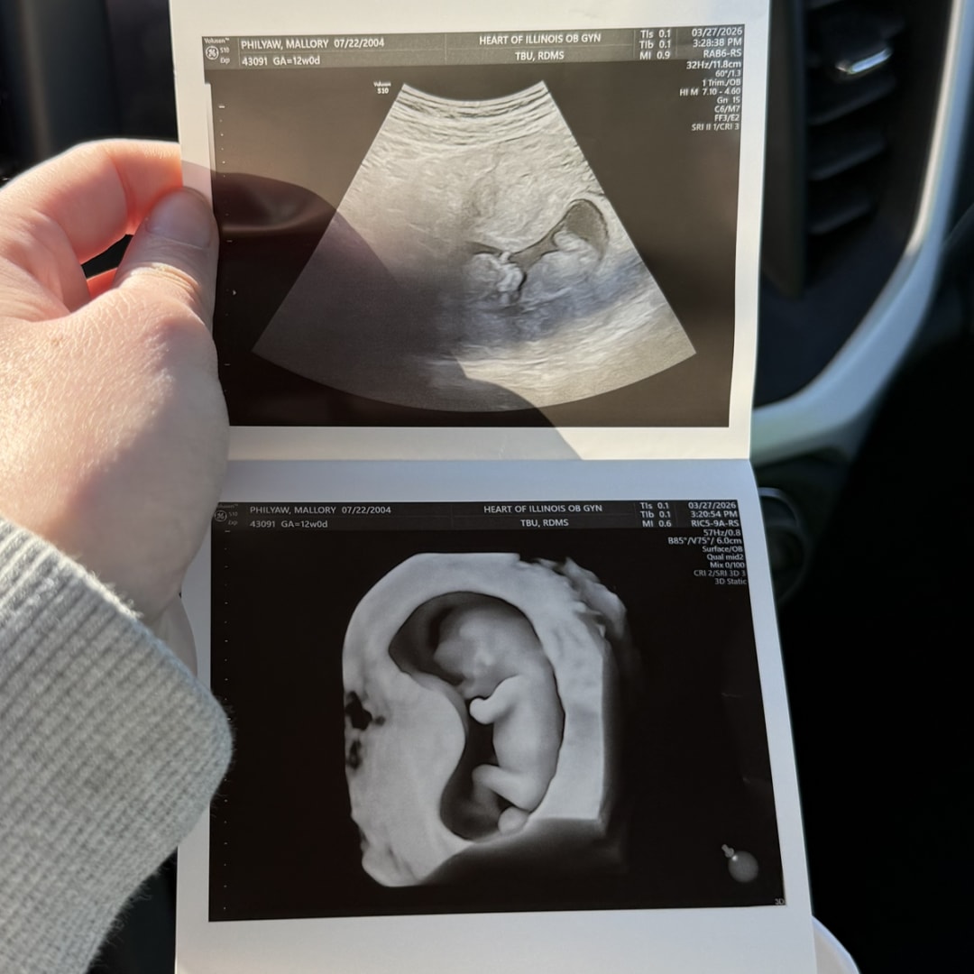 Photo shared by Mallory for their Babylist baby registry.