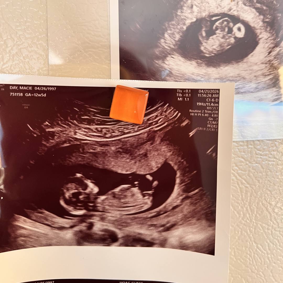Photo shared by Macie for their Babylist baby registry.