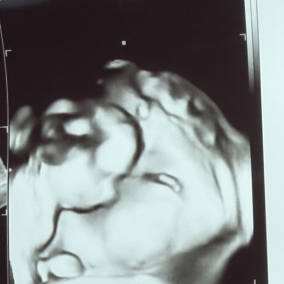 Photo shared by Masyn for their Babylist baby registry.