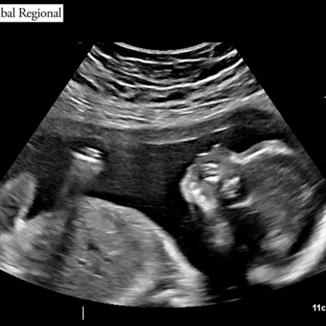 Photo shared by Lillian for their Babylist baby registry.