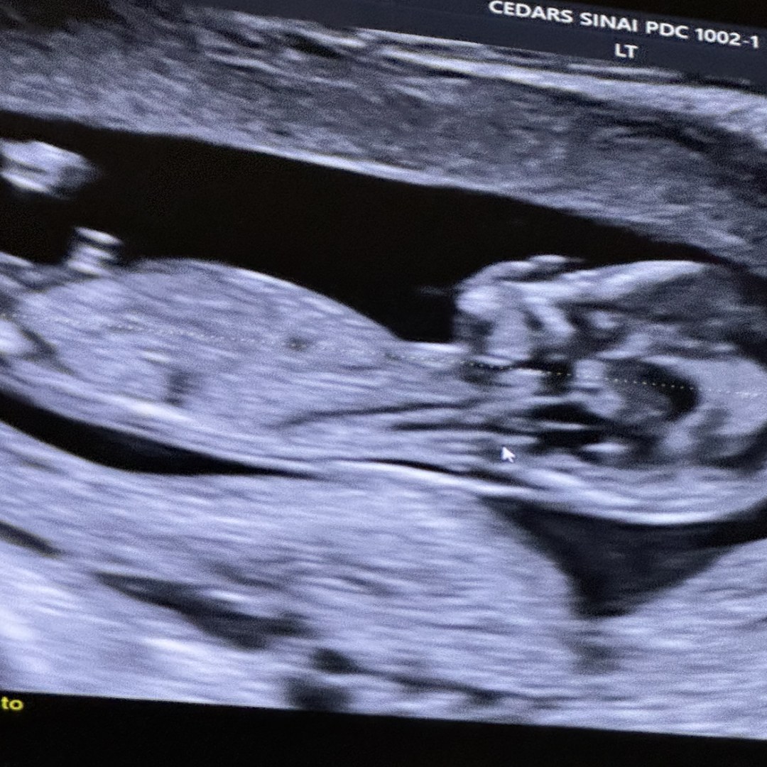 Photo shared by Stephanie for their Babylist baby registry.