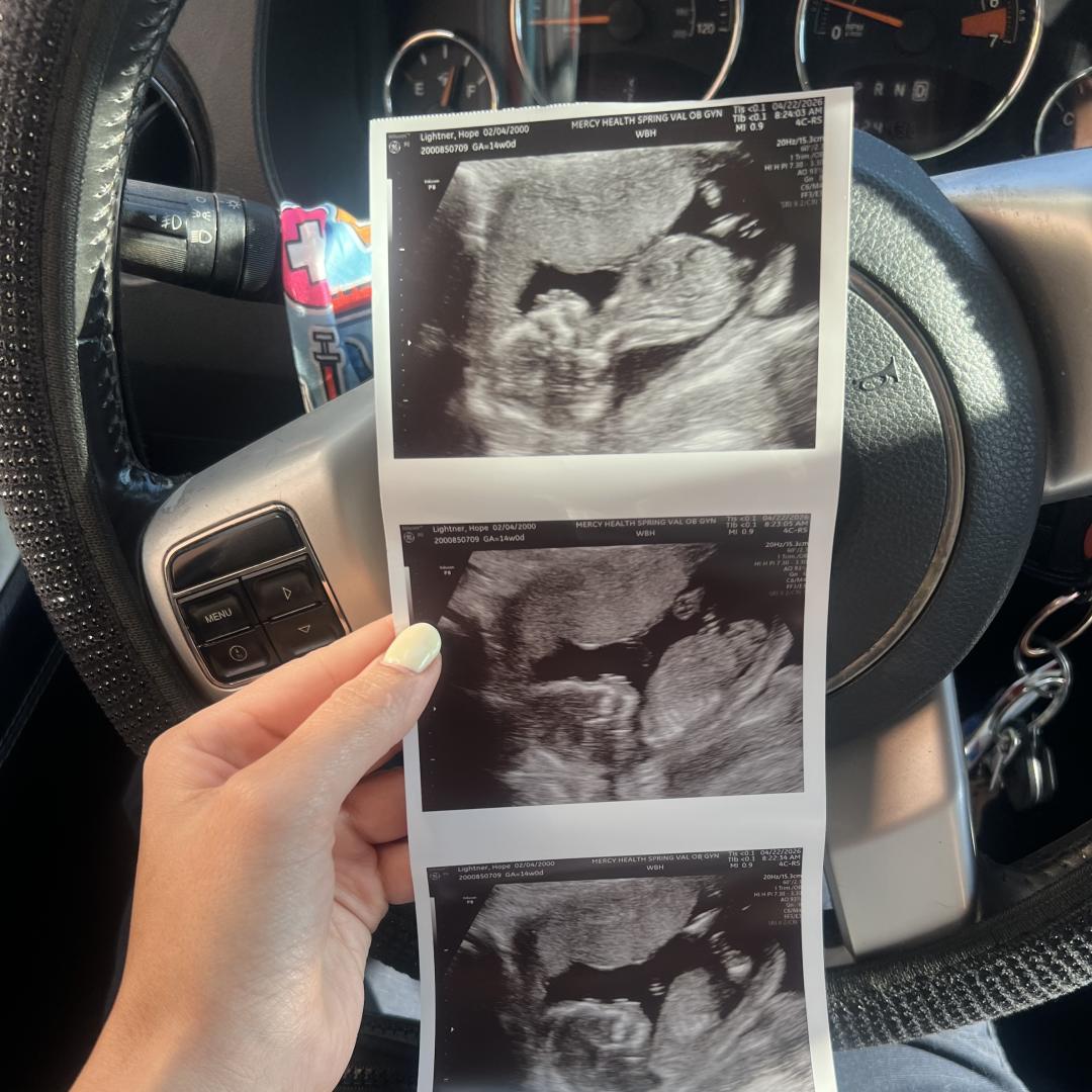 Photo shared by Hope for their Babylist baby registry.