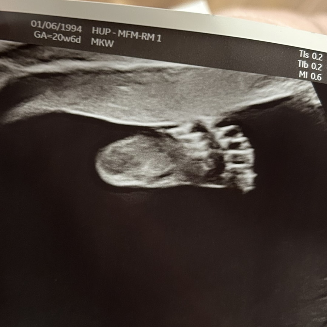 Photo shared by Amanda for their Babylist baby registry.