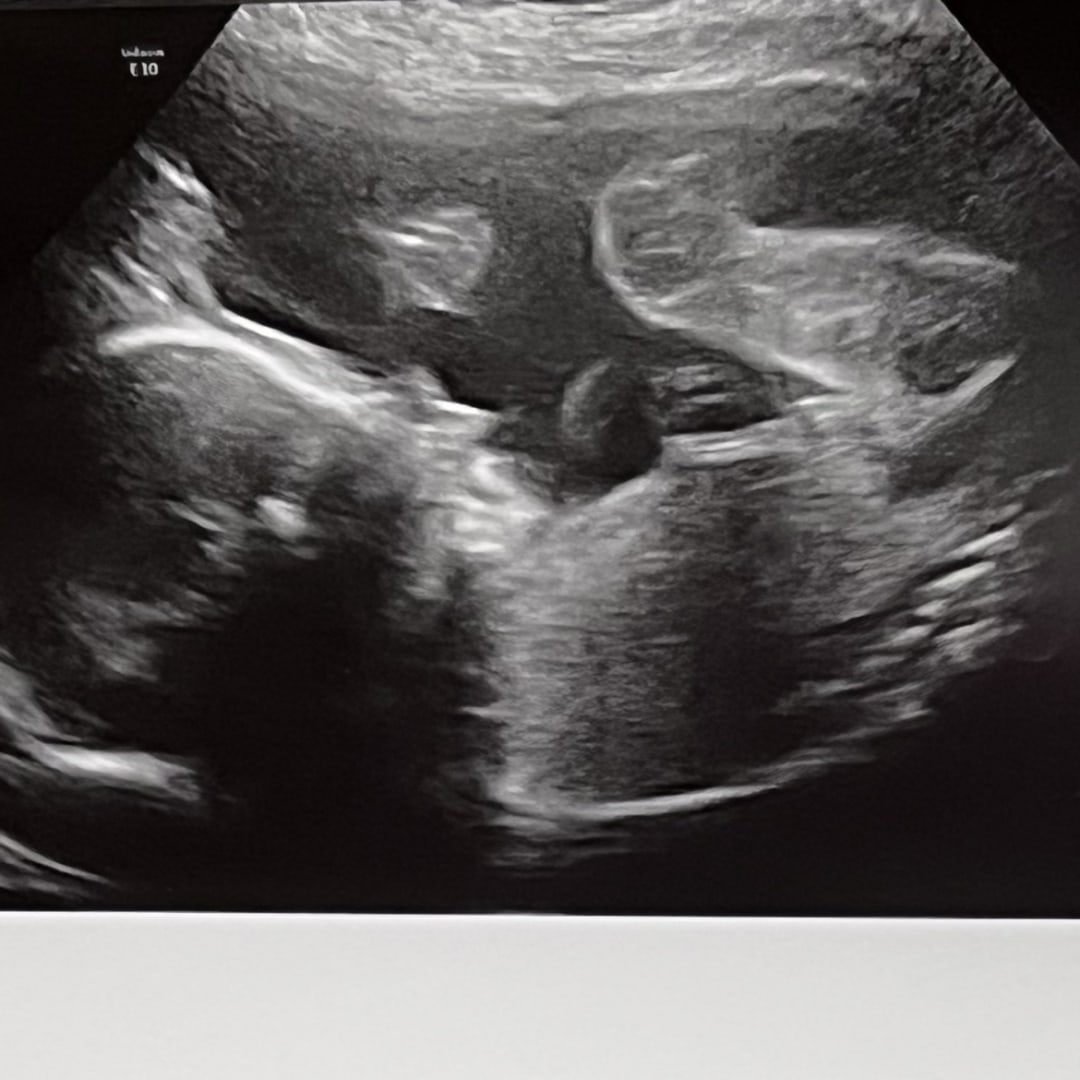 Photo shared by Royely for their Babylist baby registry.