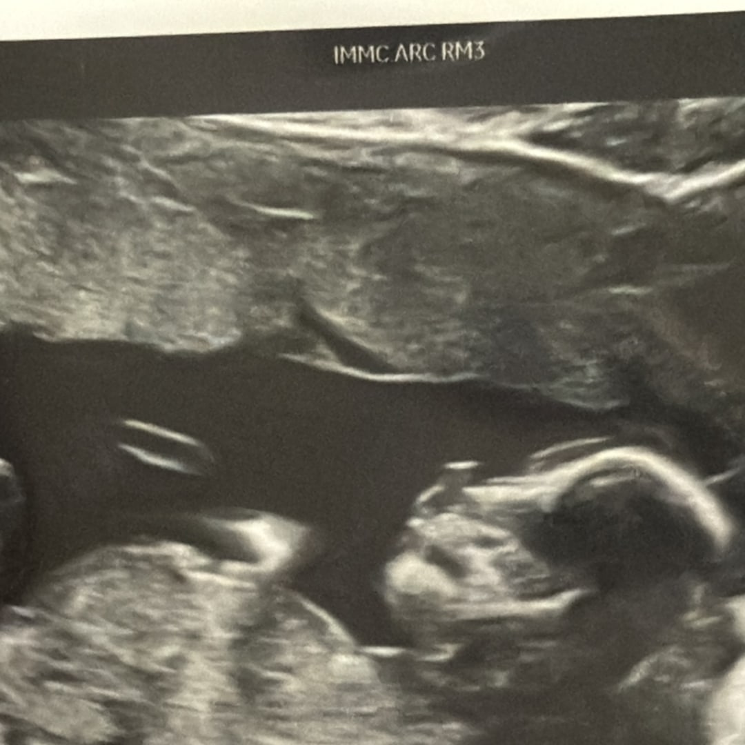 Photo shared by Maisa for their Babylist baby registry.