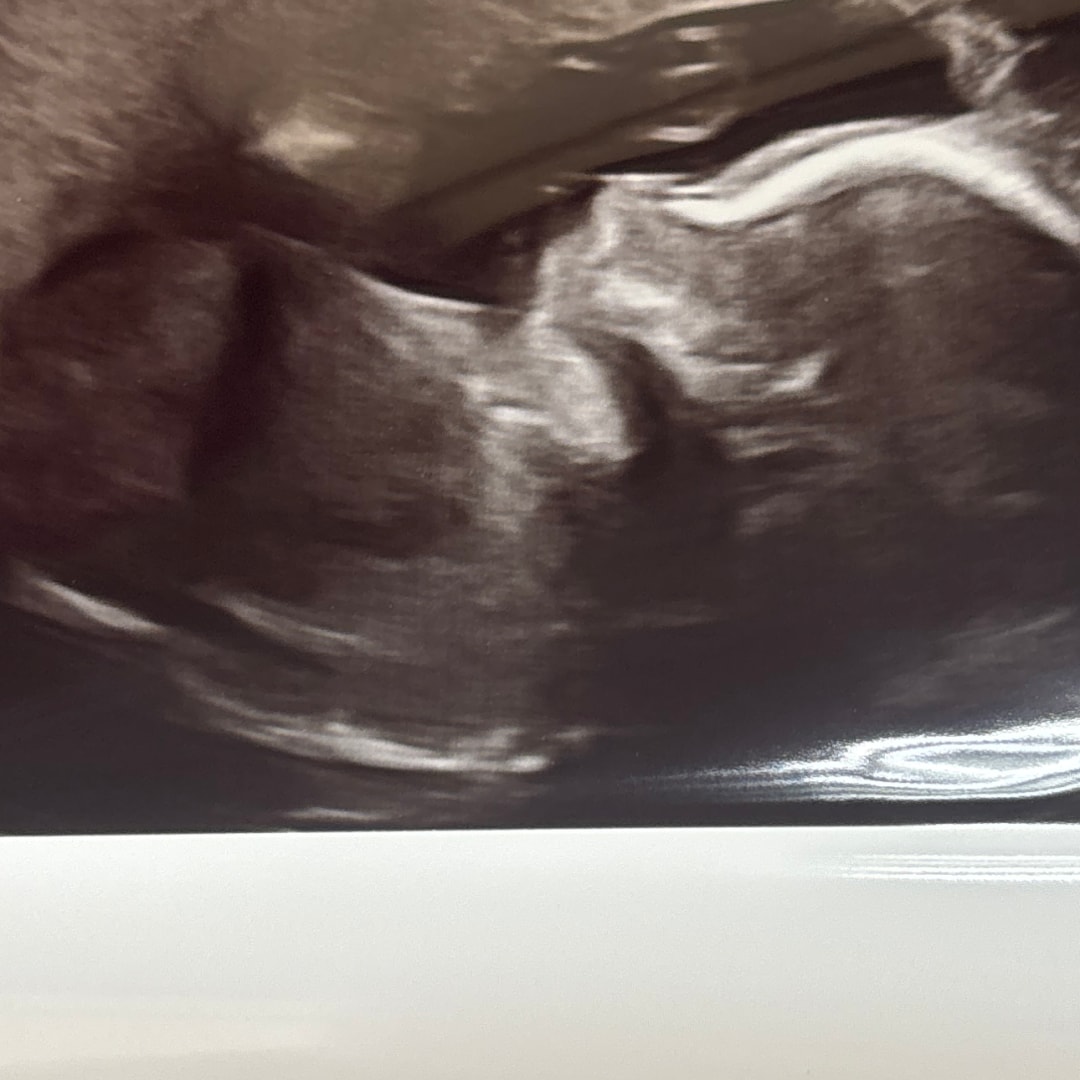 Photo shared by Mikayla for their Babylist baby registry.