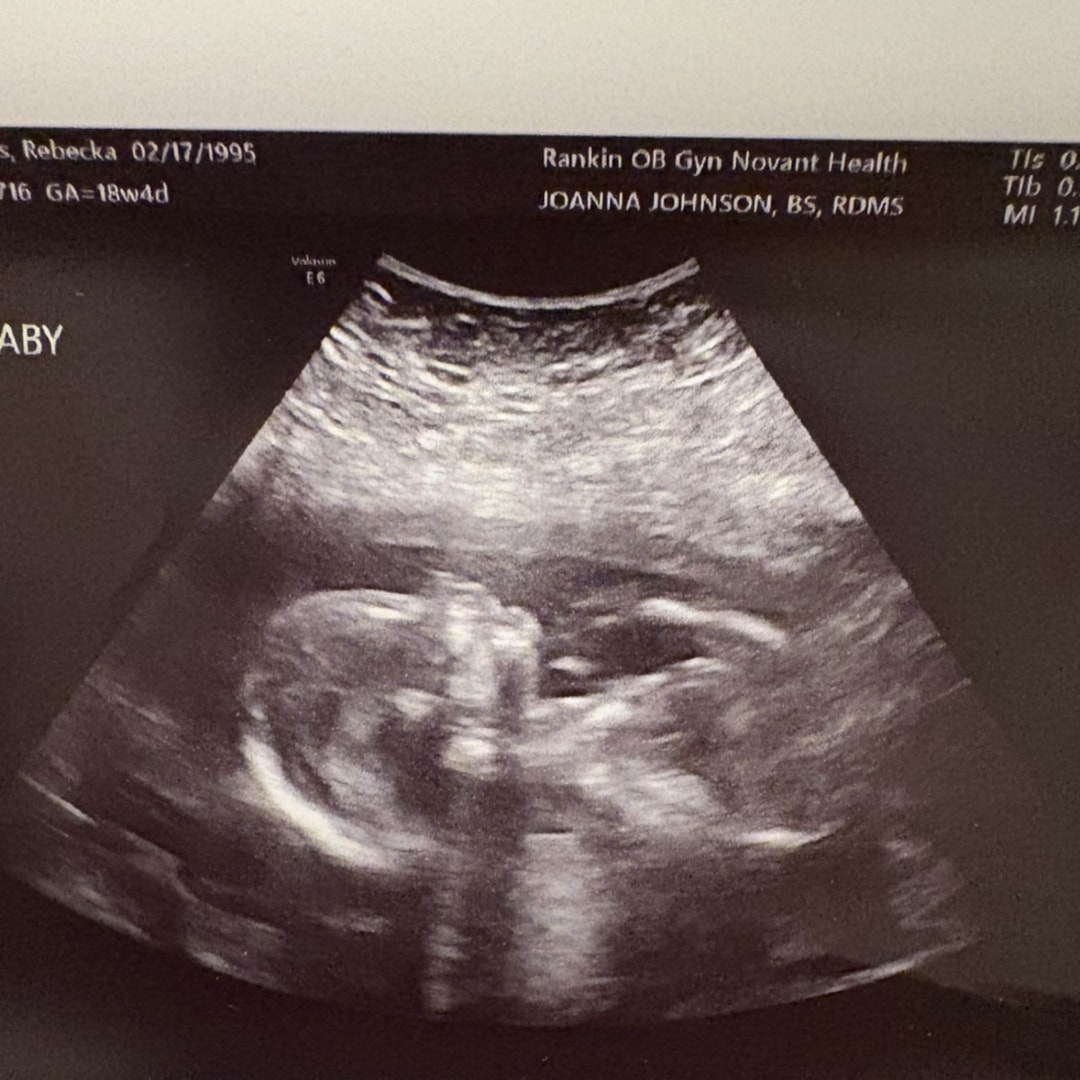 Photo shared by Rebecka for their Babylist baby registry.