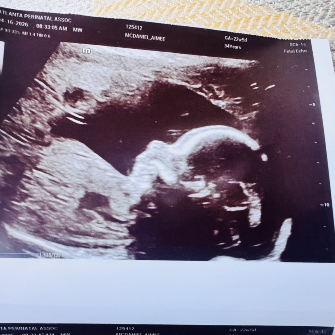 Photo shared by Aimee for their Babylist baby registry.