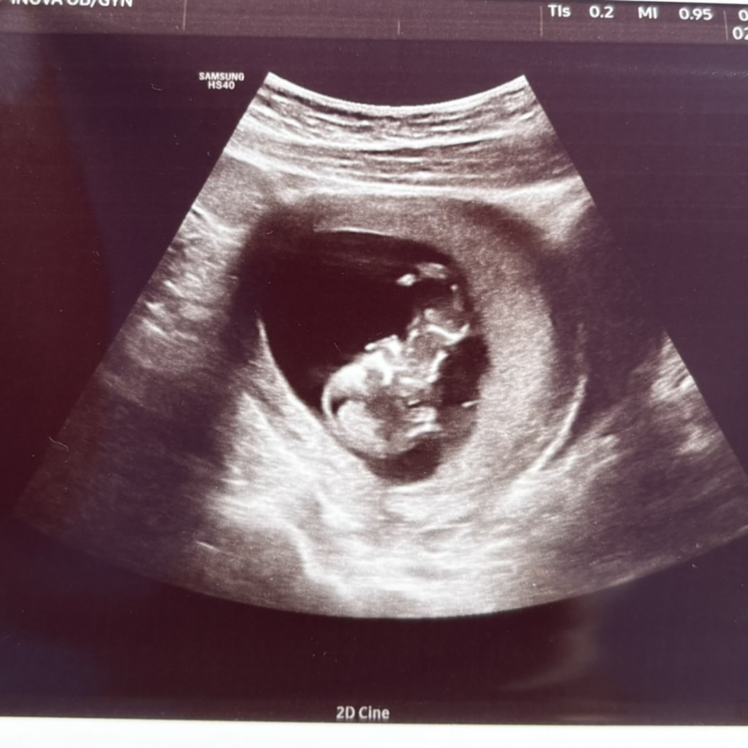 Photo shared by Annie for their Babylist baby registry.