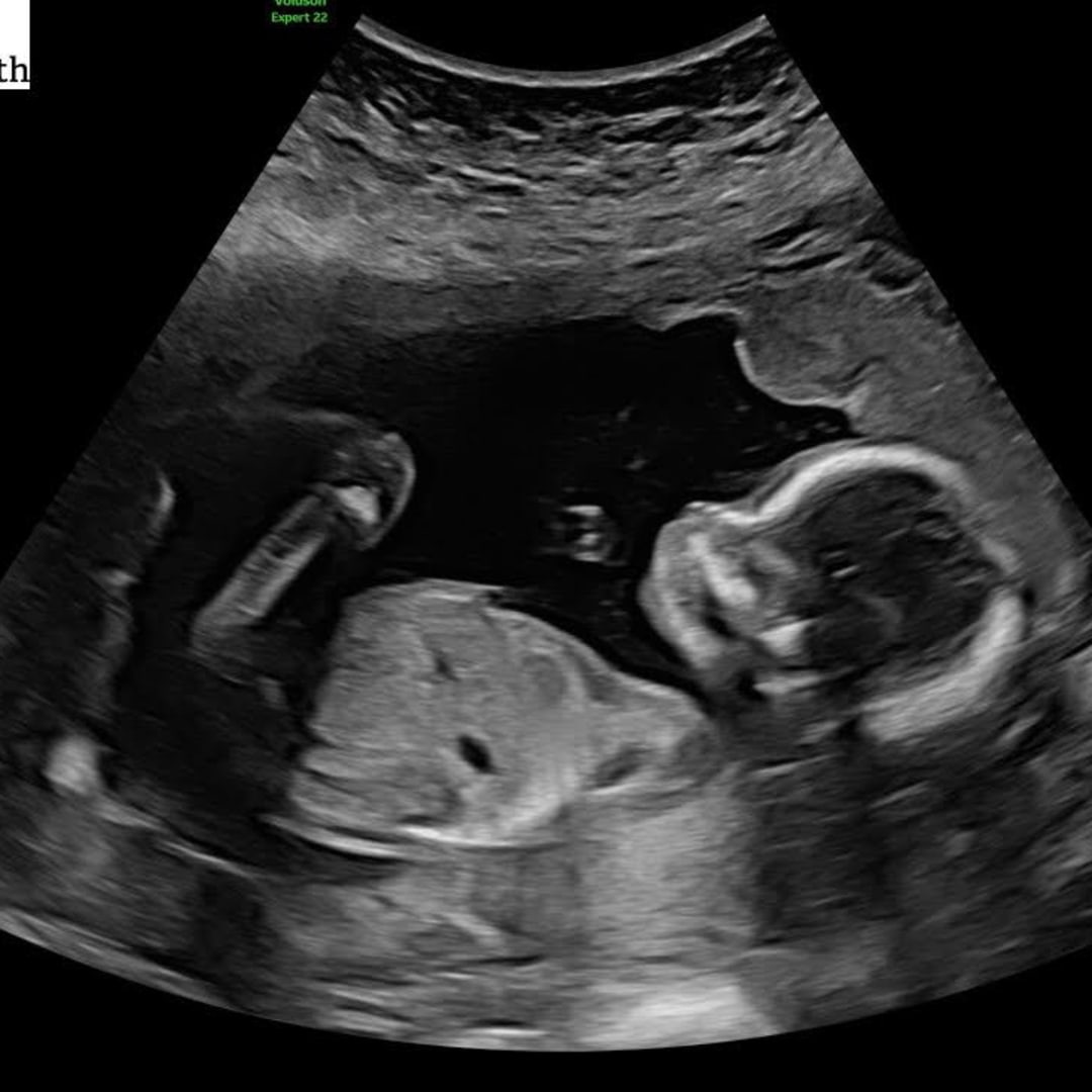 Photo shared by Hannah for their Babylist baby registry.