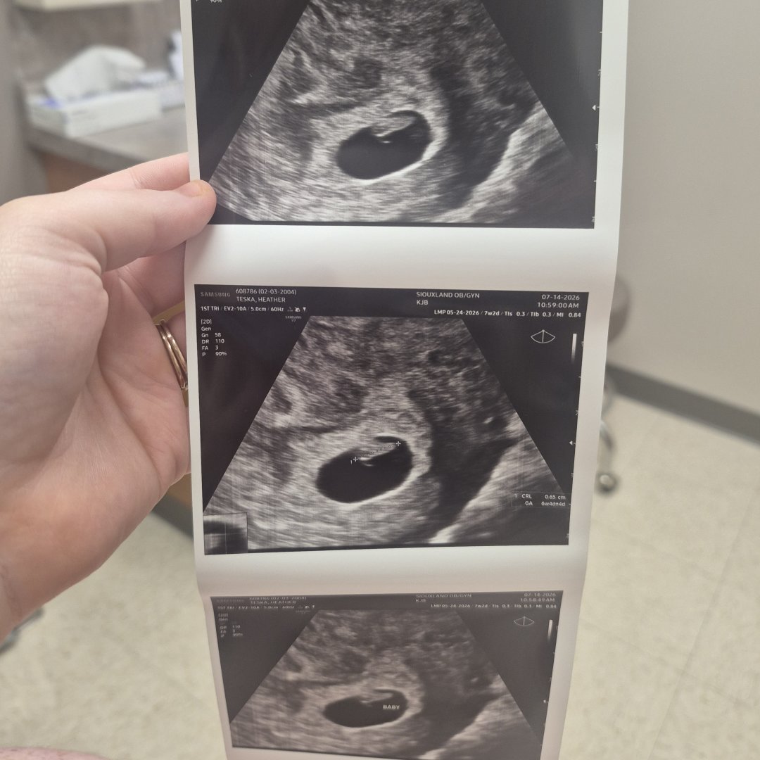 Photo shared by Heather for their Babylist baby registry.