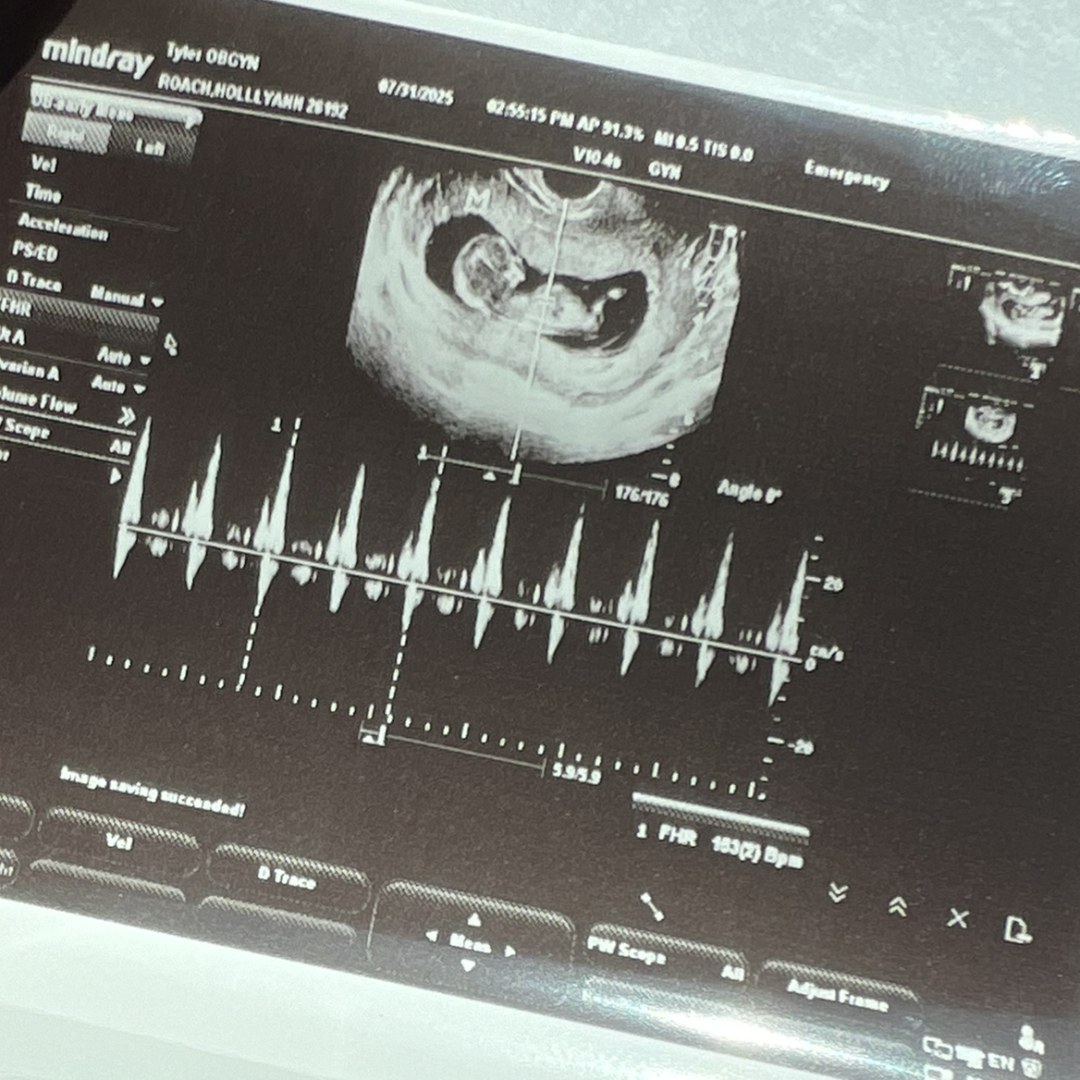 Photo shared by Hollyann for their Babylist baby registry.