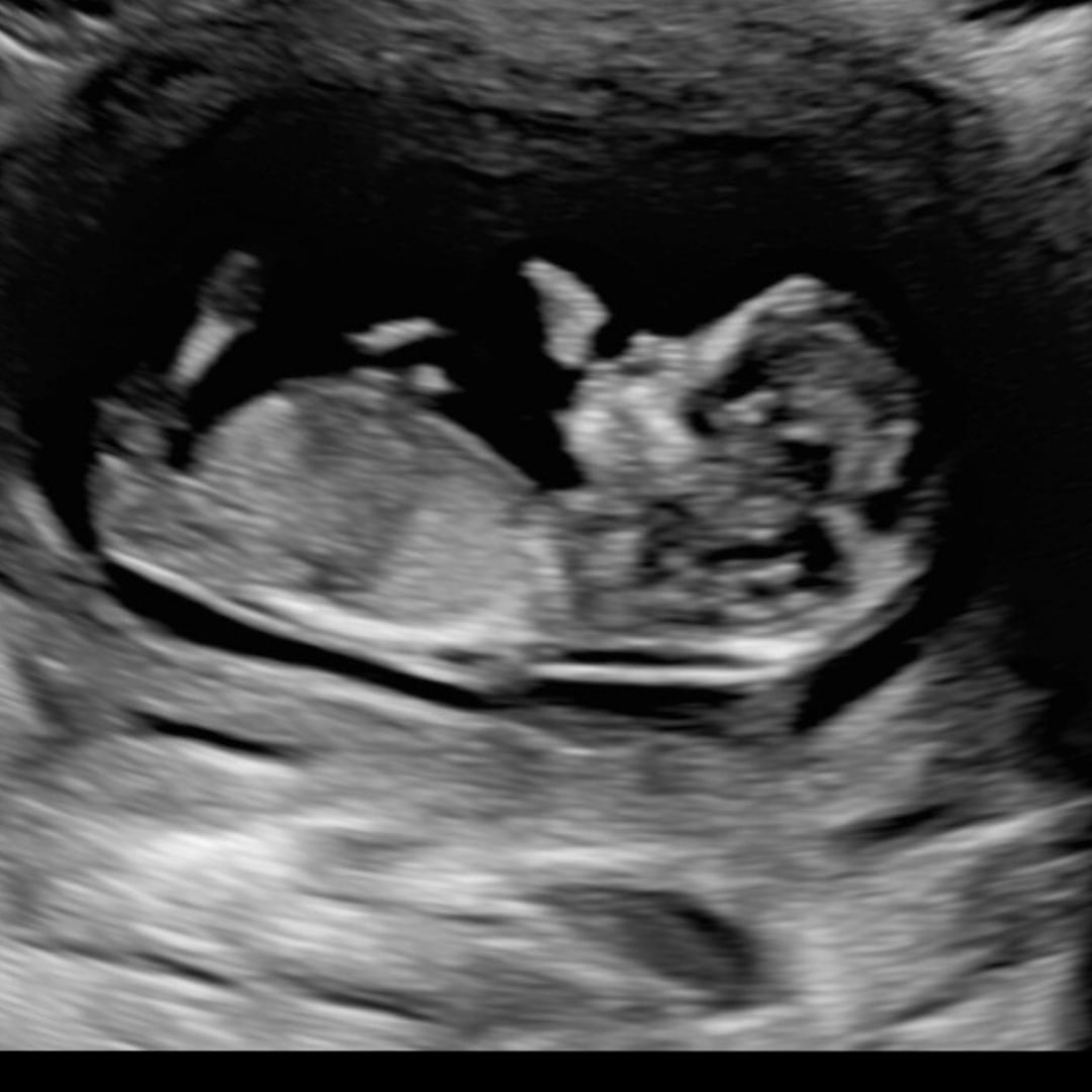 Photo shared by Kaili for their Babylist baby registry.