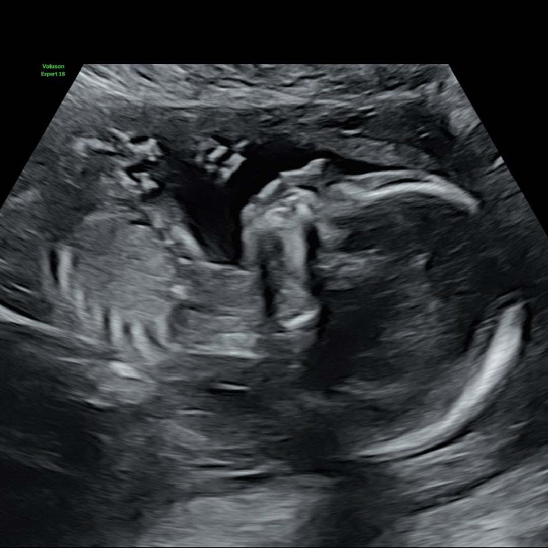 Photo shared by Zoe for their Babylist baby registry.
