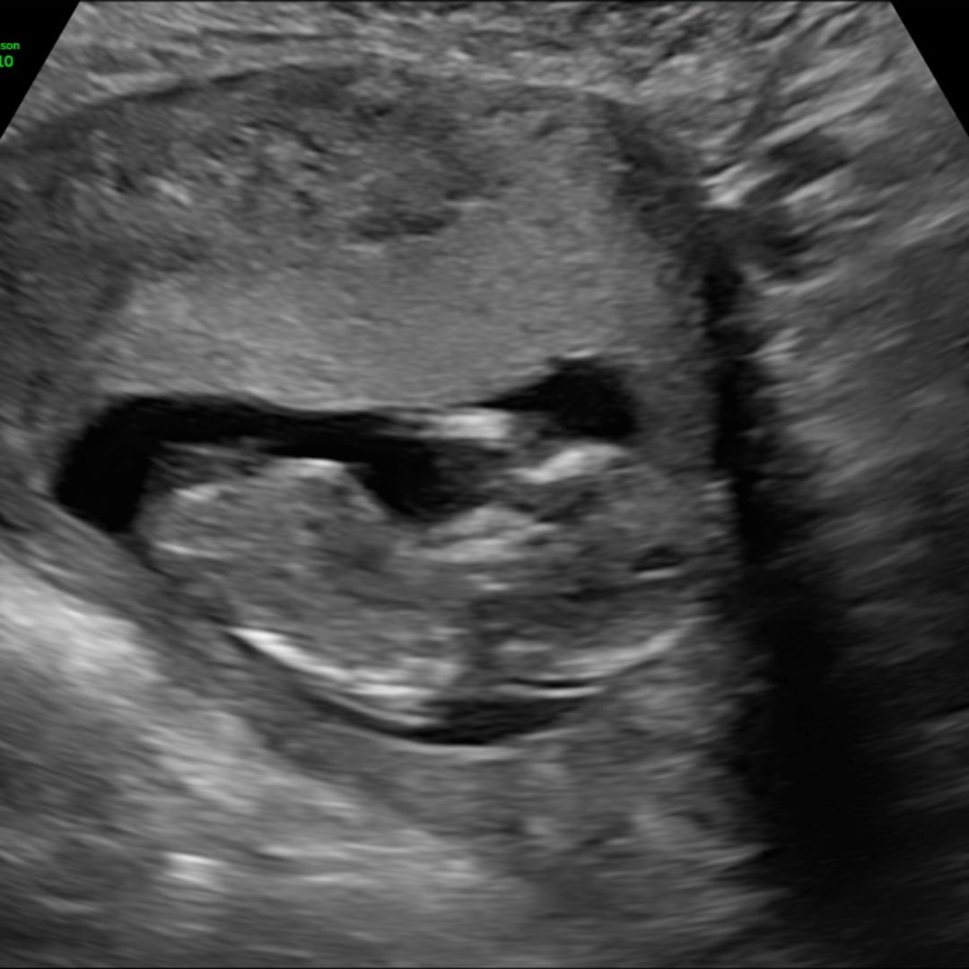 Photo shared by Briana for their Babylist baby registry.