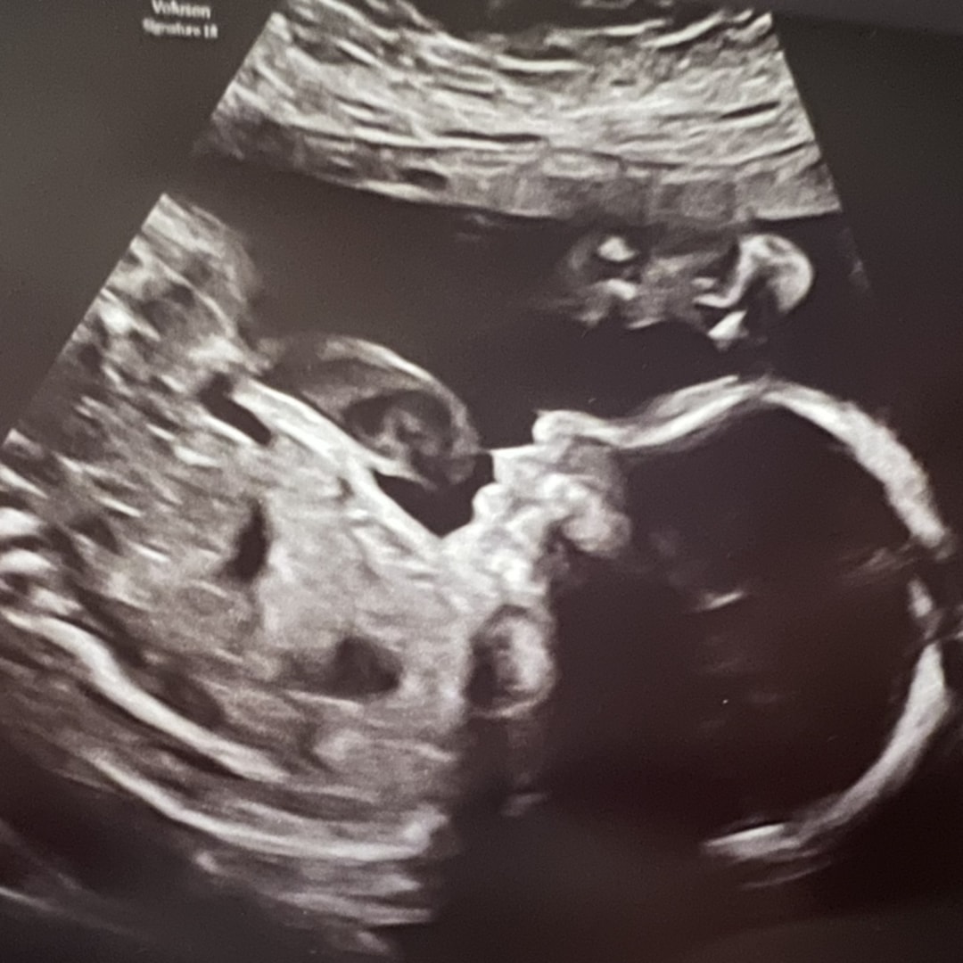 Photo shared by Courtney for their Babylist baby registry.