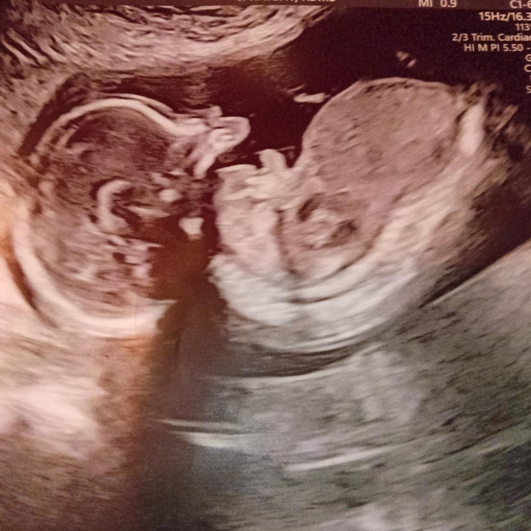 Photo shared by Janiya for their Babylist baby registry.