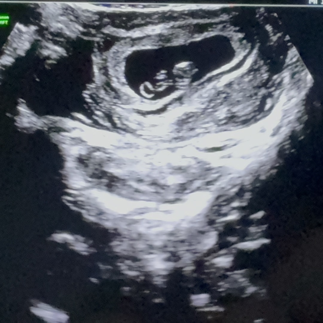 Photo shared by Rae’Chell for their Babylist baby registry.