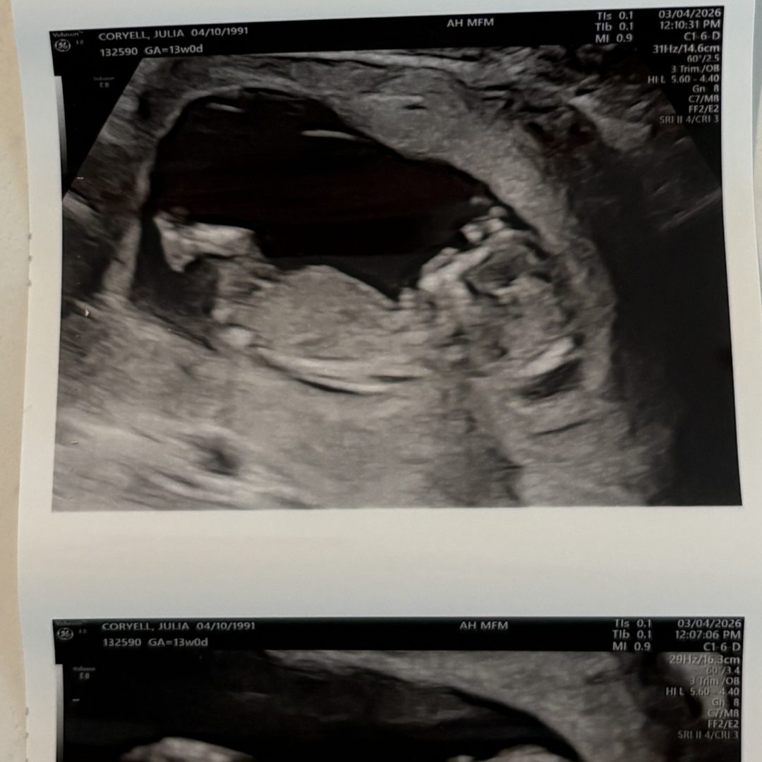 Photo shared by Andrew for their Babylist baby registry.