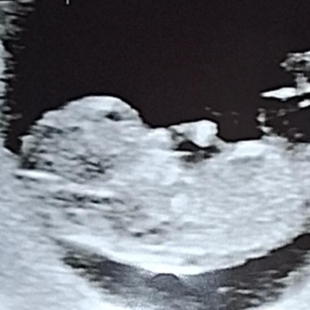 Photo shared by Trinity for their Babylist baby registry.