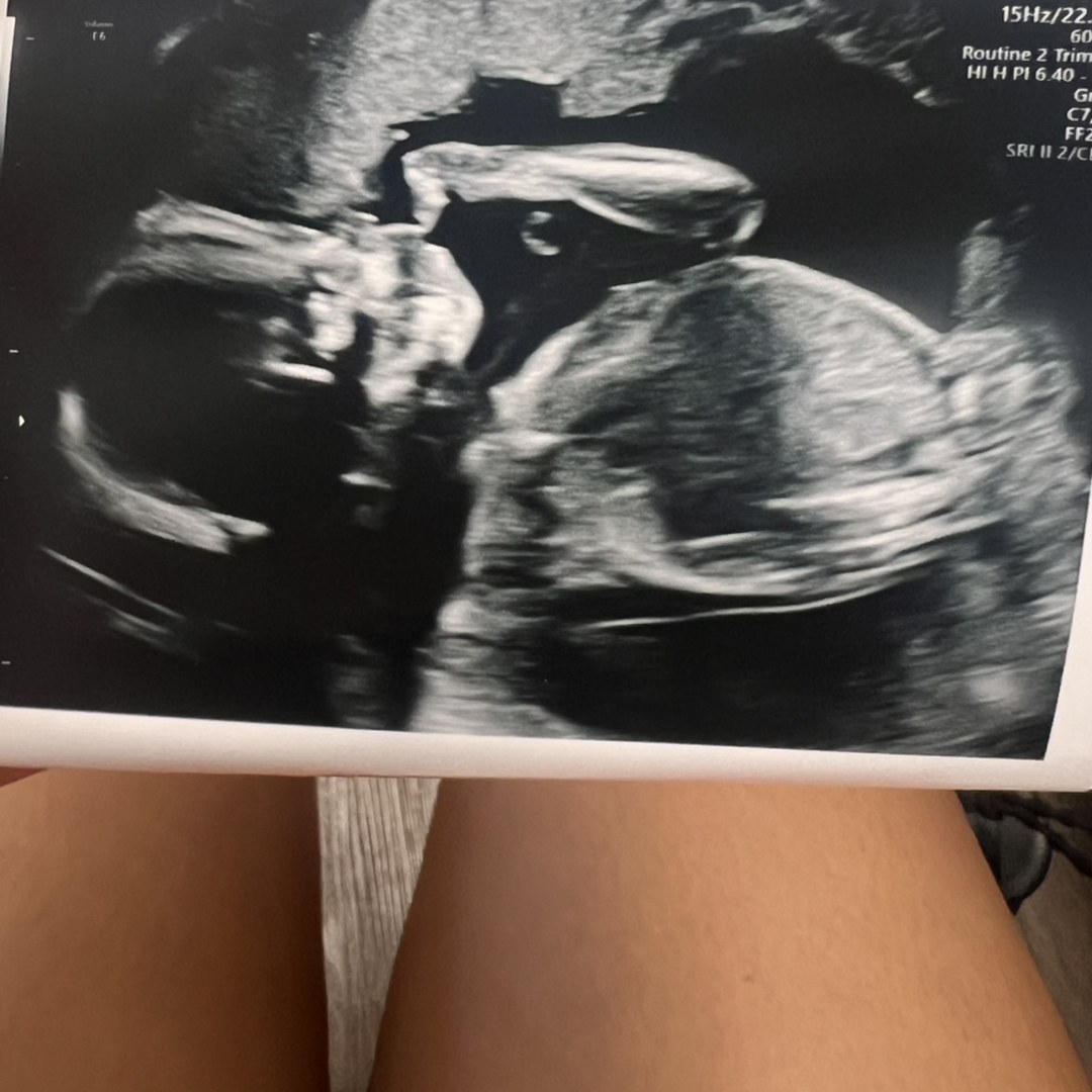 Photo shared by Melissa for their Babylist baby registry.