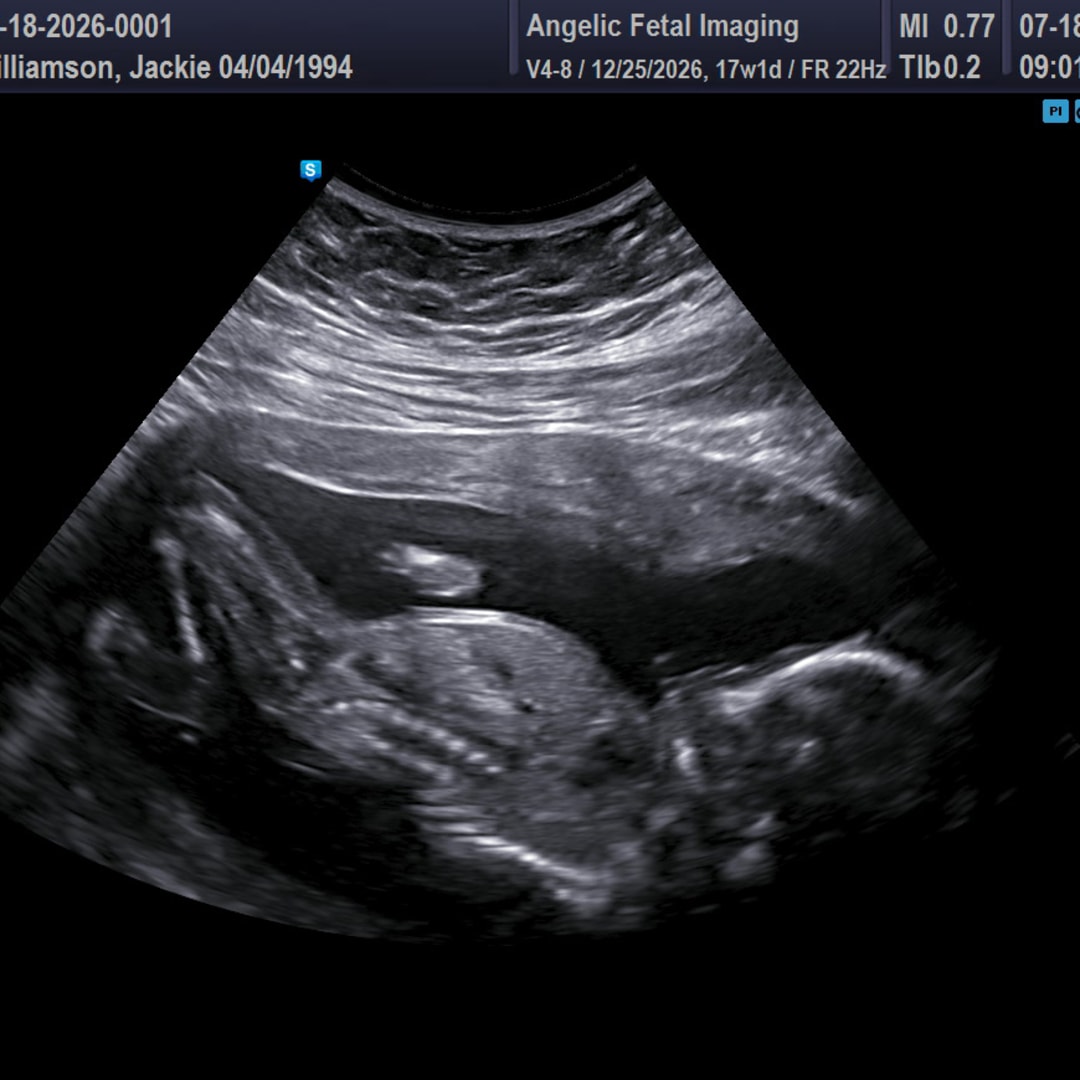 Photo shared by Jacqueline for their Babylist baby registry.