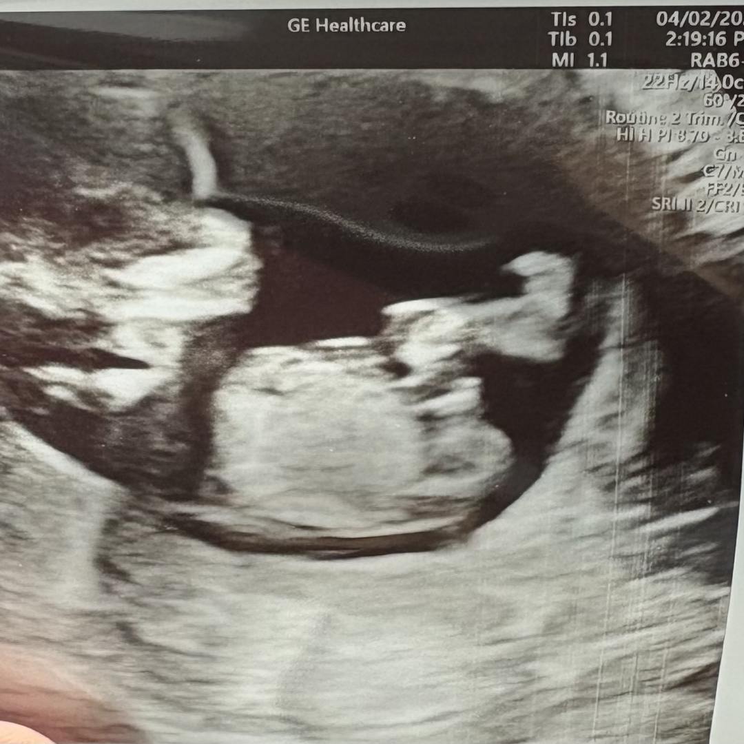 Photo shared by Alicia for their Babylist baby registry.
