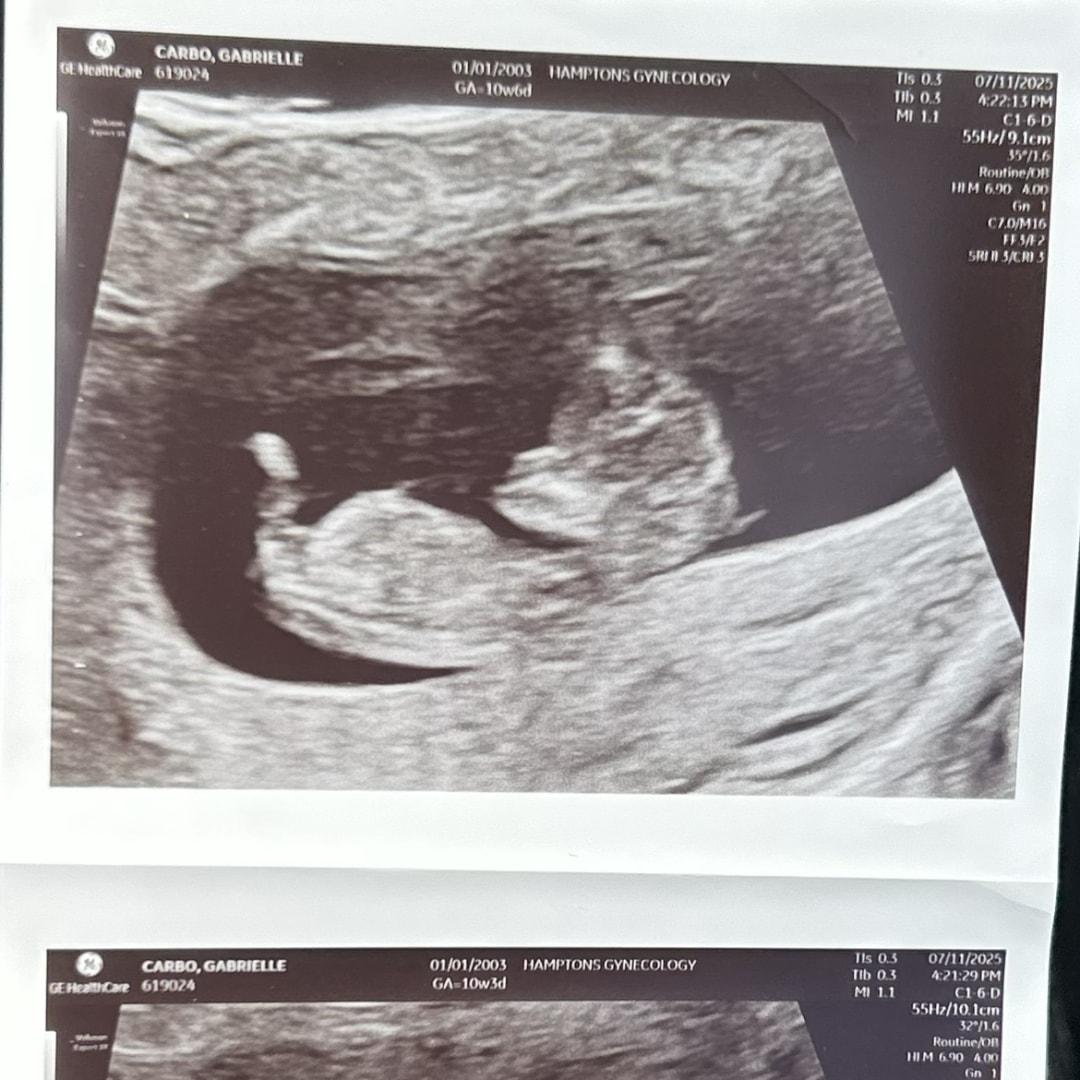 Photo shared by Gabrielle for their Babylist baby registry.