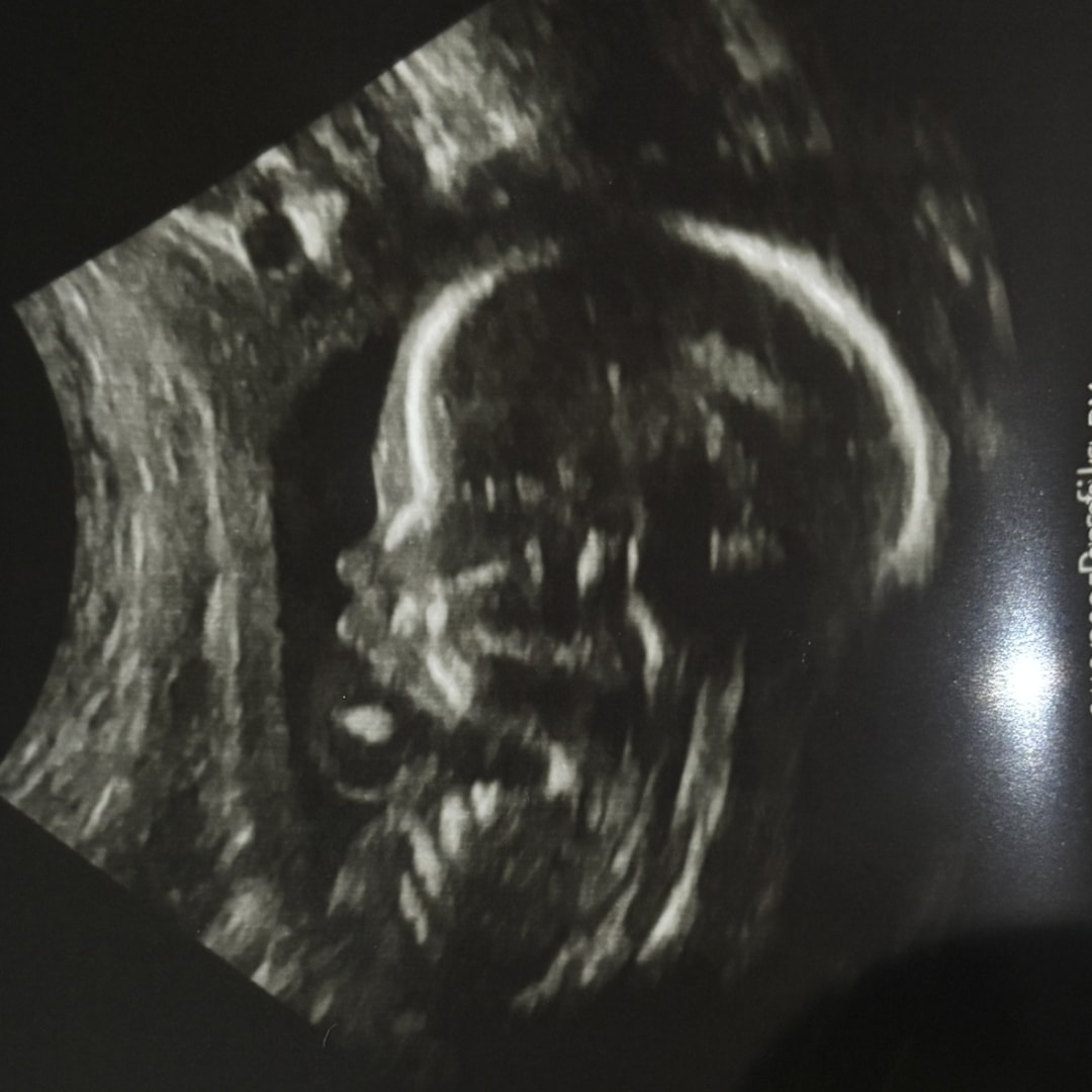 Photo shared by Cecilia for their Babylist baby registry.