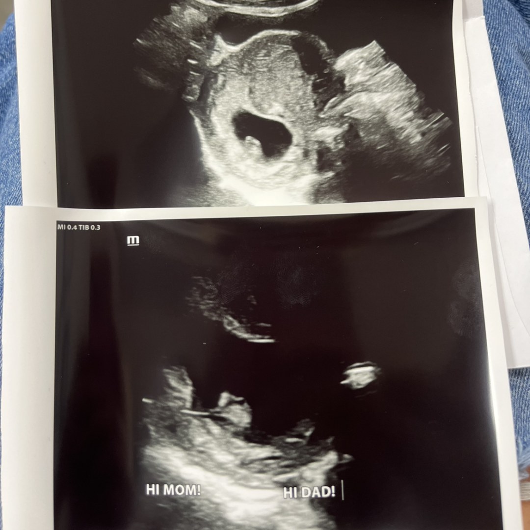 Photo shared by Julia for their Babylist baby registry.