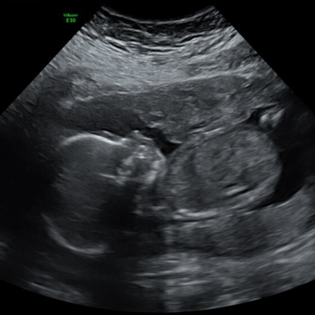 Photo shared by Diana for their Babylist baby registry.
