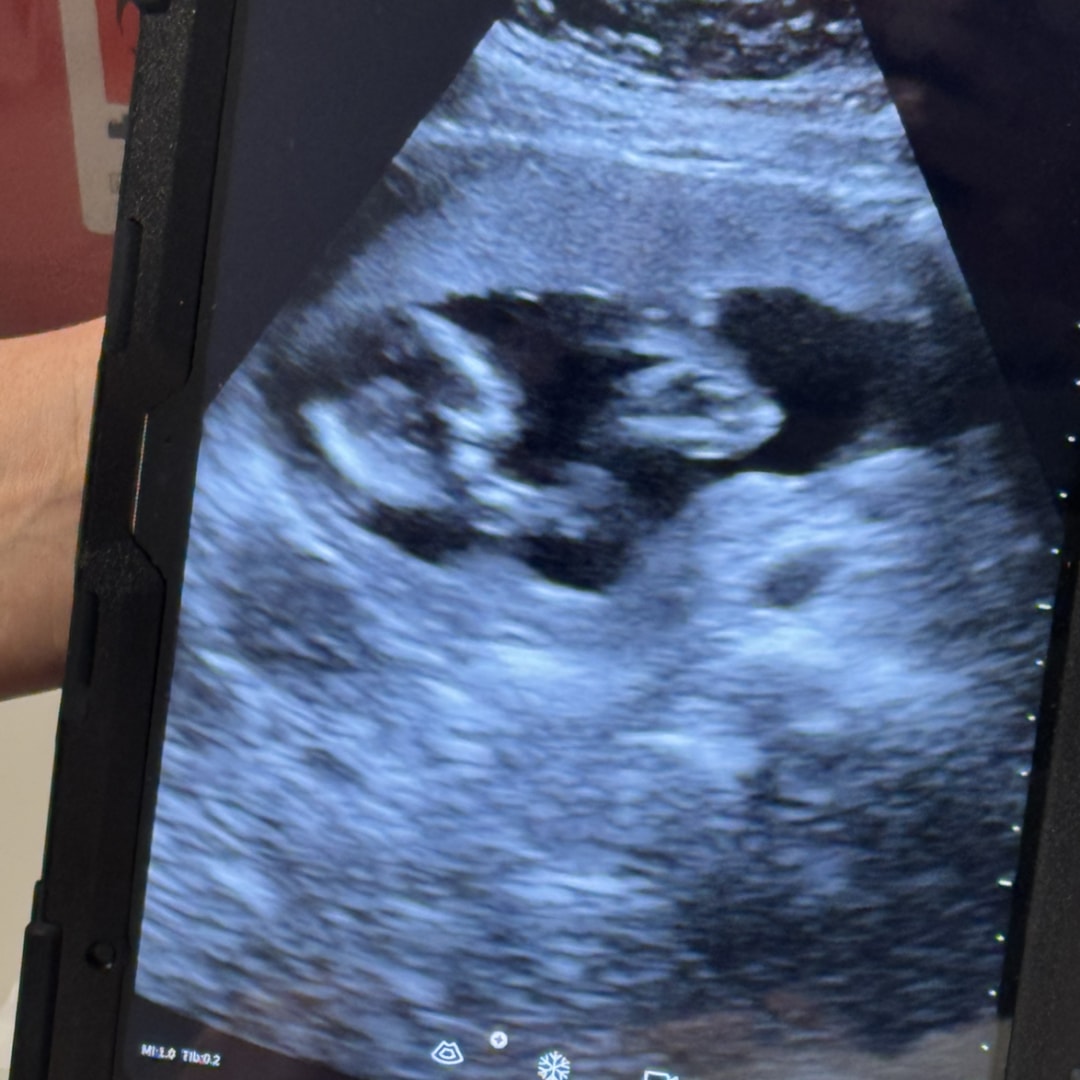 Photo shared by Kenzie for their Babylist baby registry.