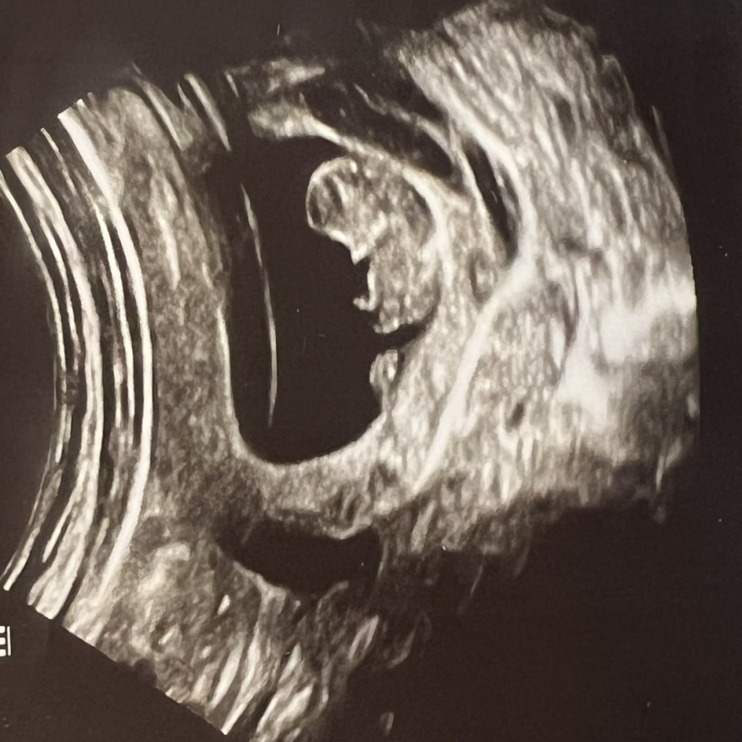 Photo shared by Annabell for their Babylist baby registry.