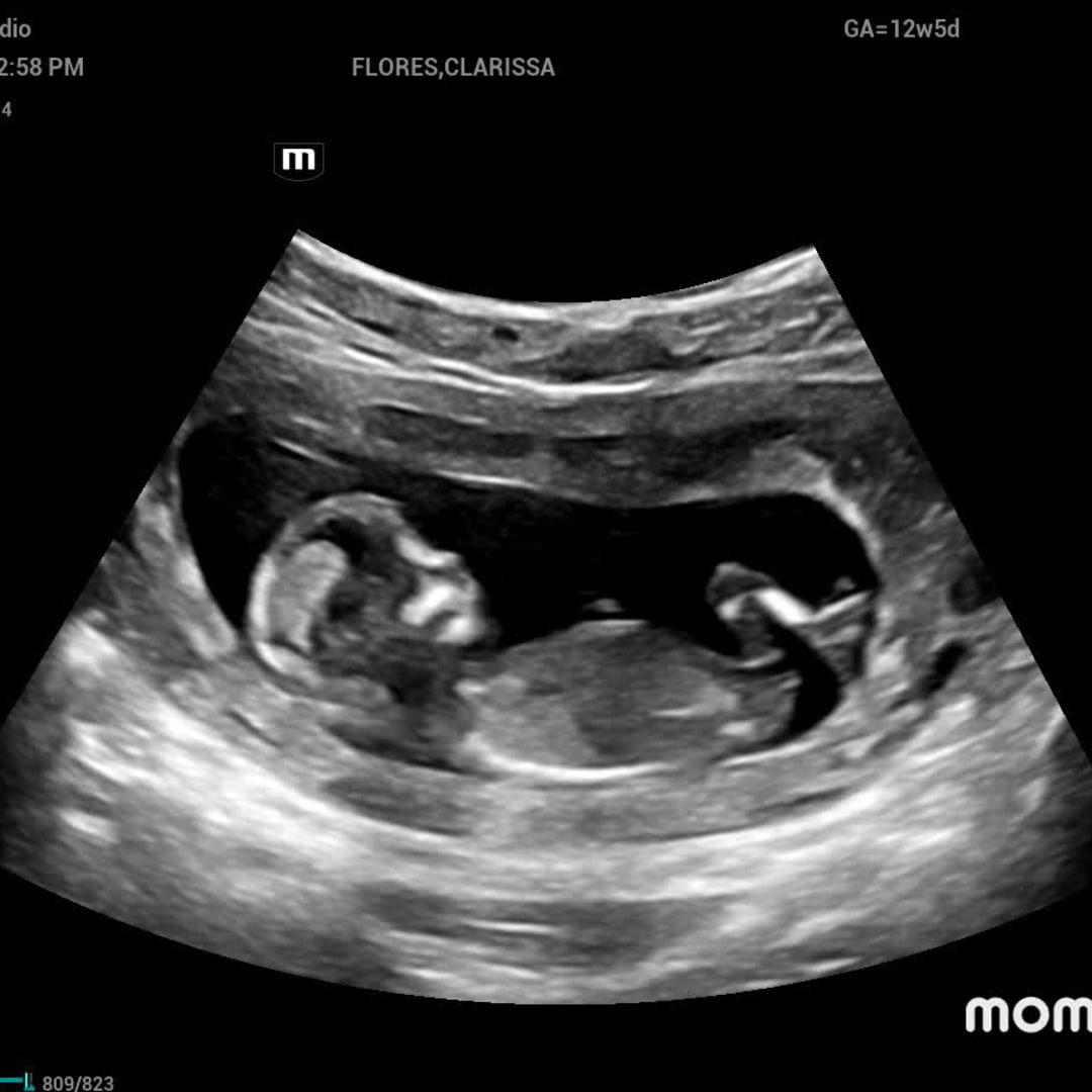 Photo shared by Clarissa for their Babylist baby registry.